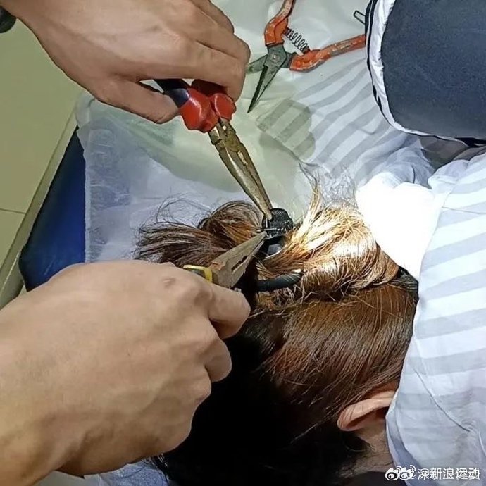 女子头戴鲨鱼夹摔倒致植物人状态及其应对指南