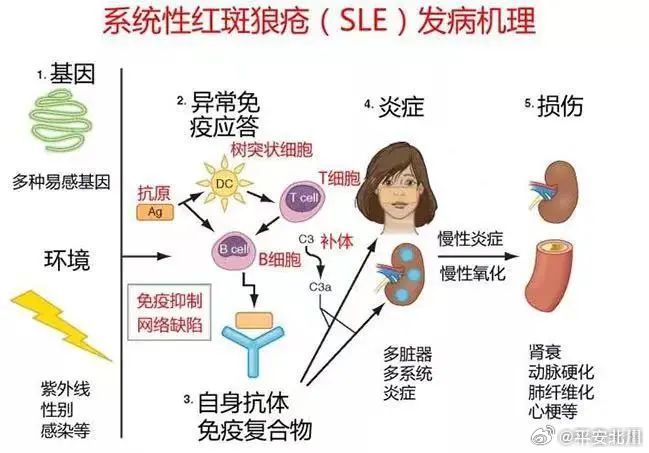 红斑狼疮揭秘，为何被称为不死的癌症？