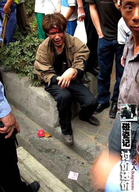 应对突发情况，老人撞人欲走，女子阻拦遭咬事件应对指南