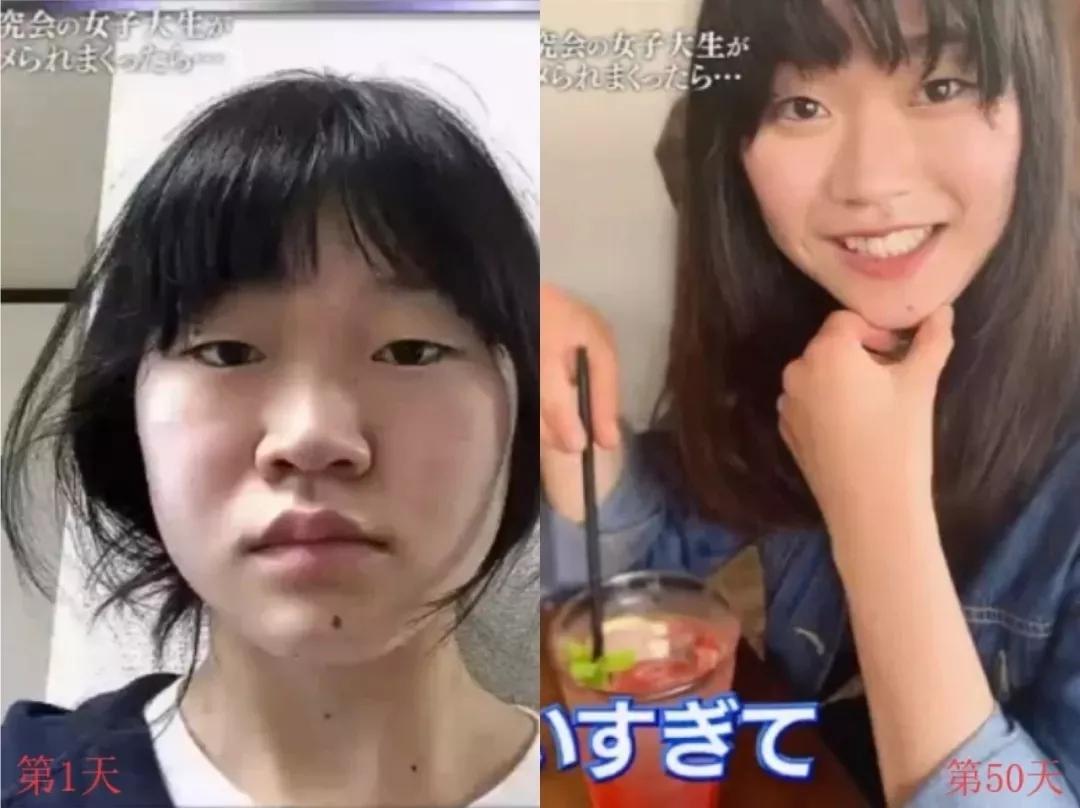 小丽的新颜与友情力量，最新整容分享