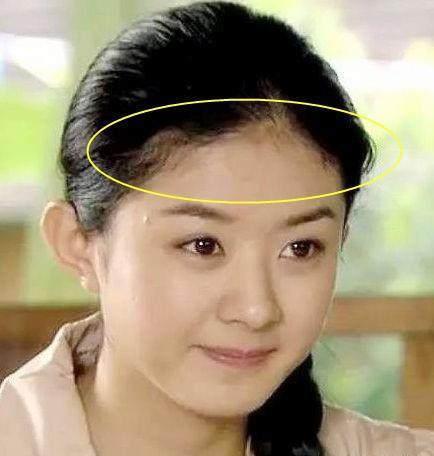 明星额头高,明星额头高背后的秘密，小巷中的独特小店